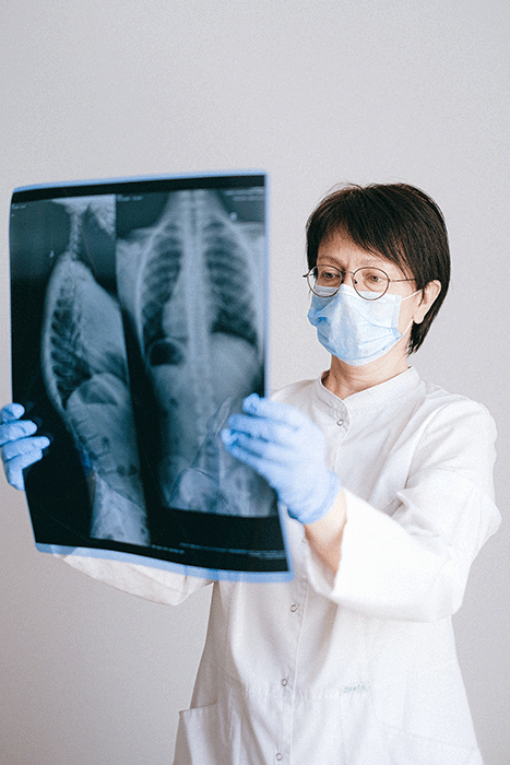 Doctor studying an x-ray